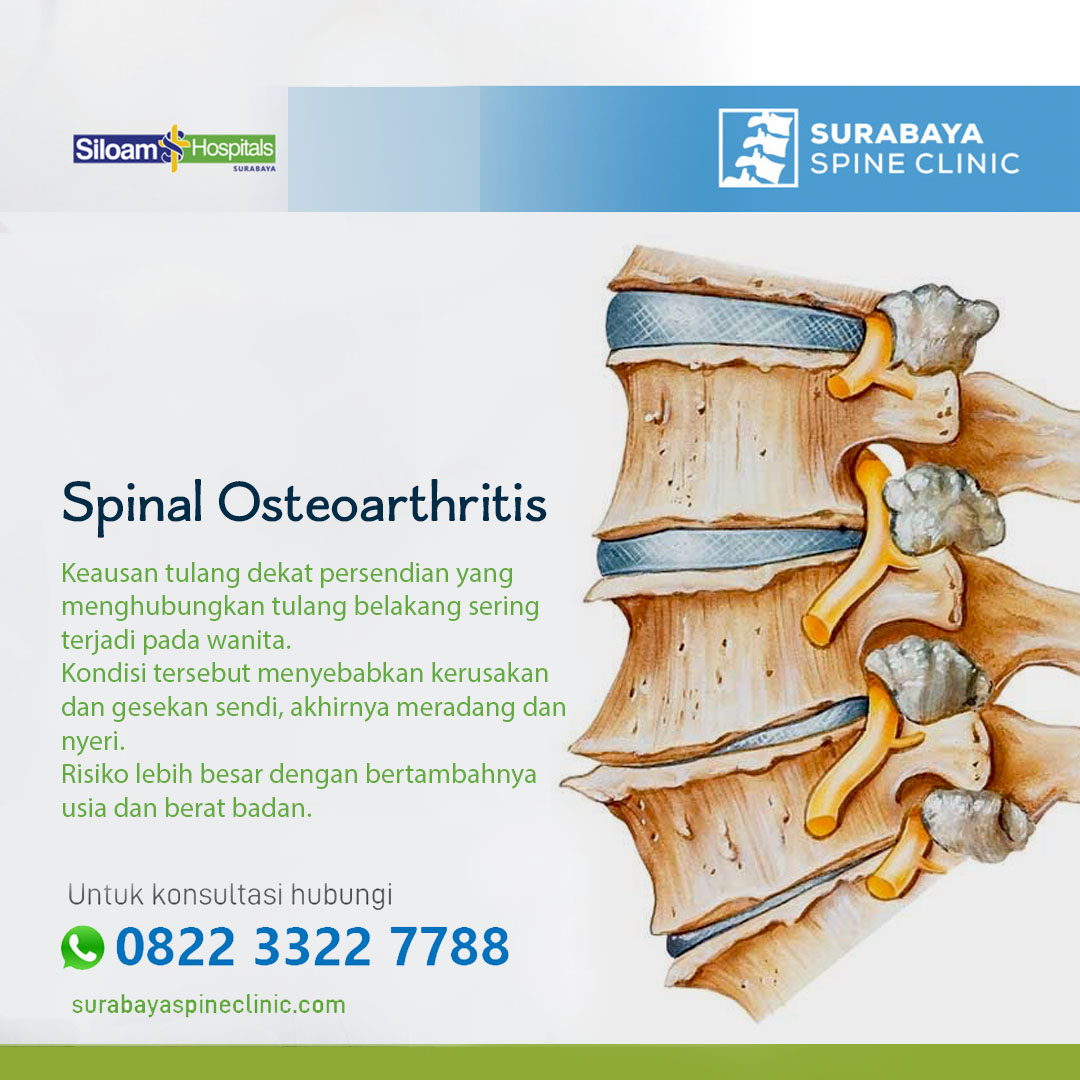 Spinal Osteoarthritis 